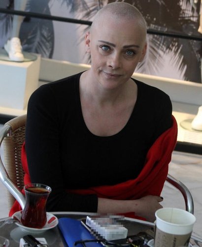 Dilek Serbest