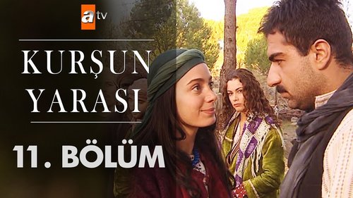 Bullet Wound (Kurşun Yarası)
