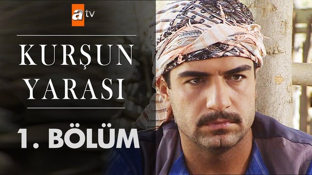 Kurşun Yarası